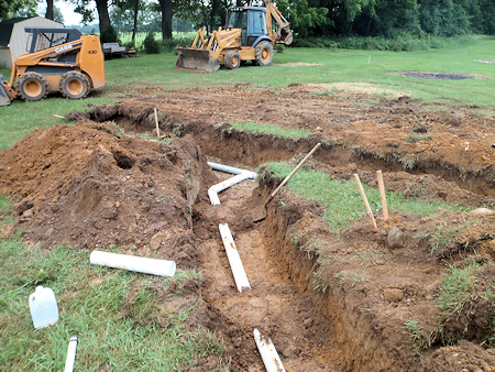 Drainage