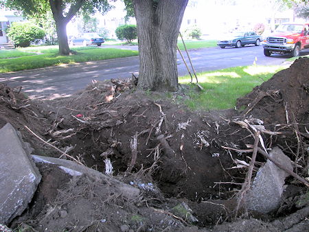 Drainage